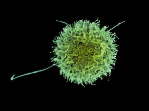 Natural Kill cell